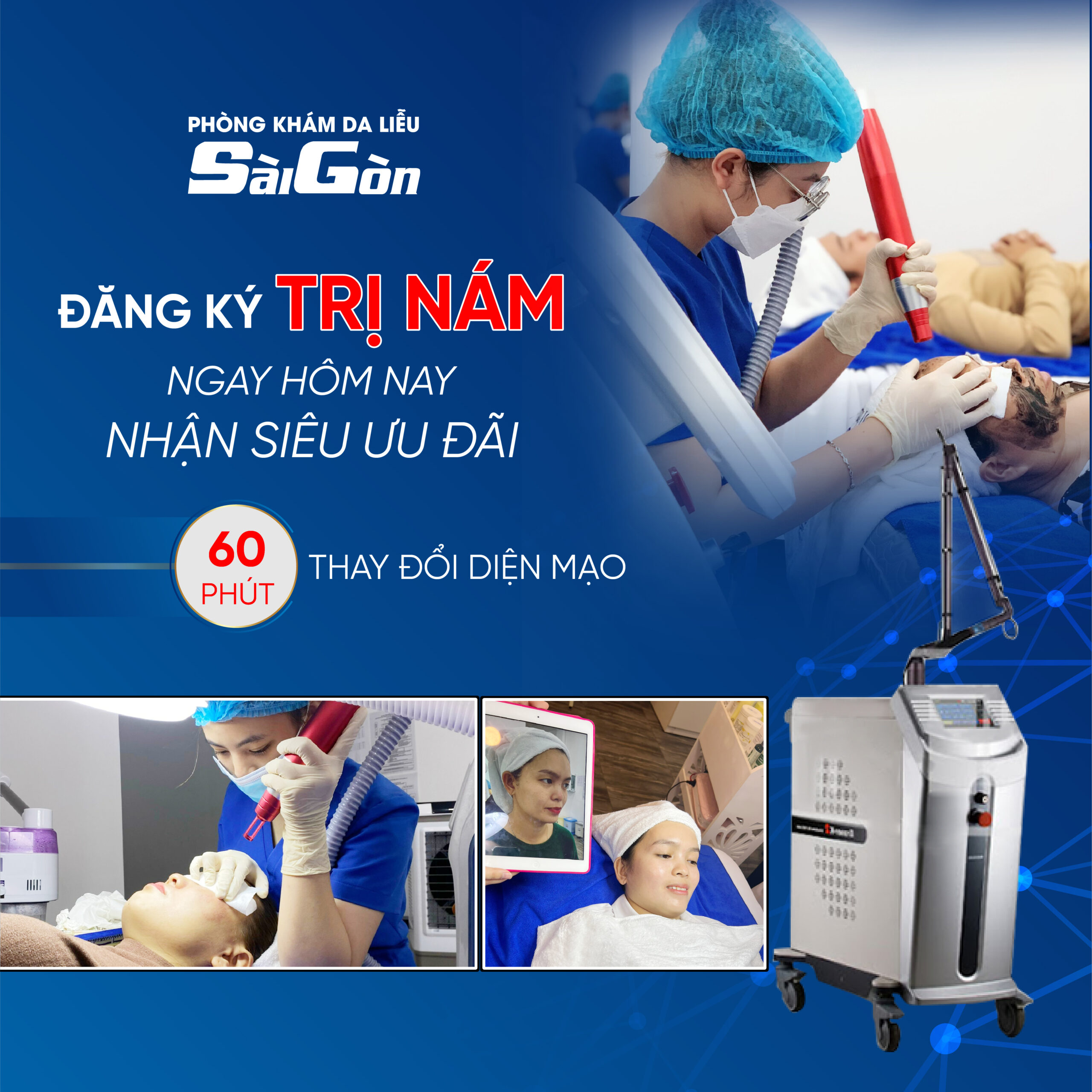 Xóa Nám tại da liễu sài gòn