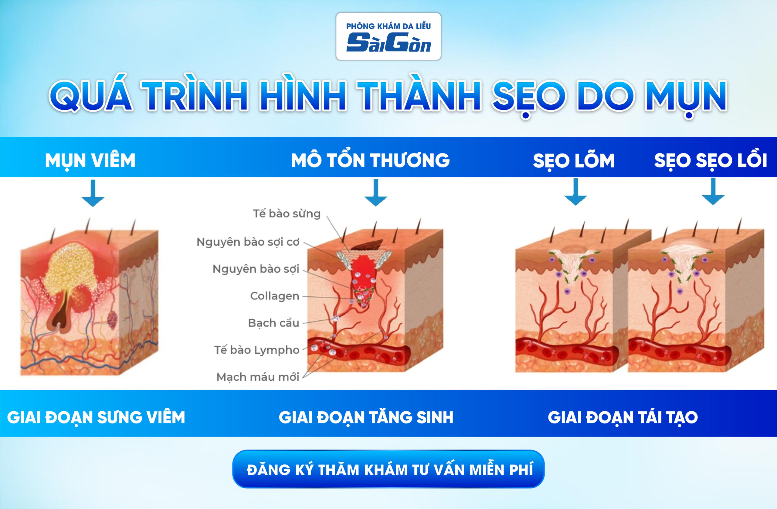 Điều trị Da tại Đà Lạt