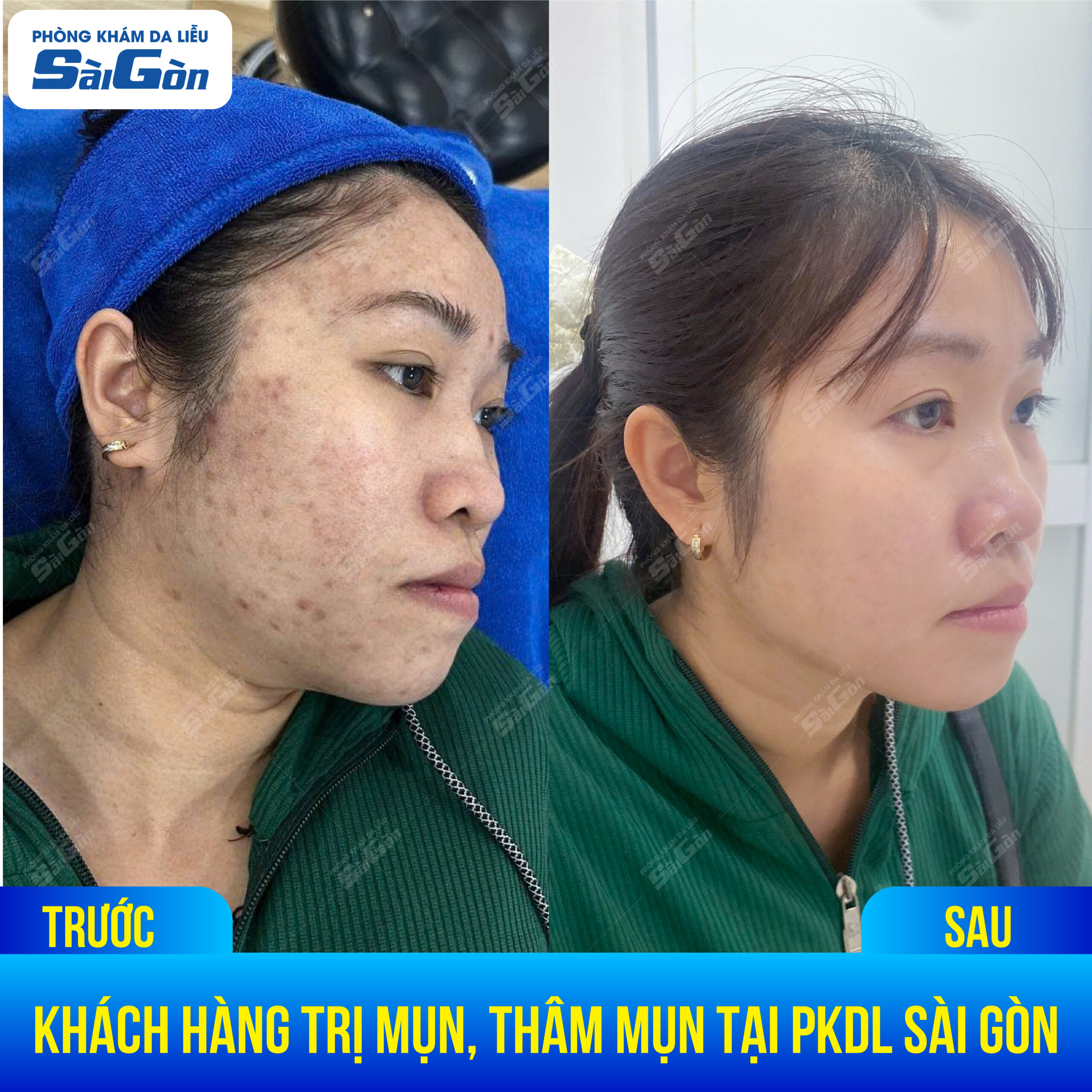 Da Liễu Đà Lạt