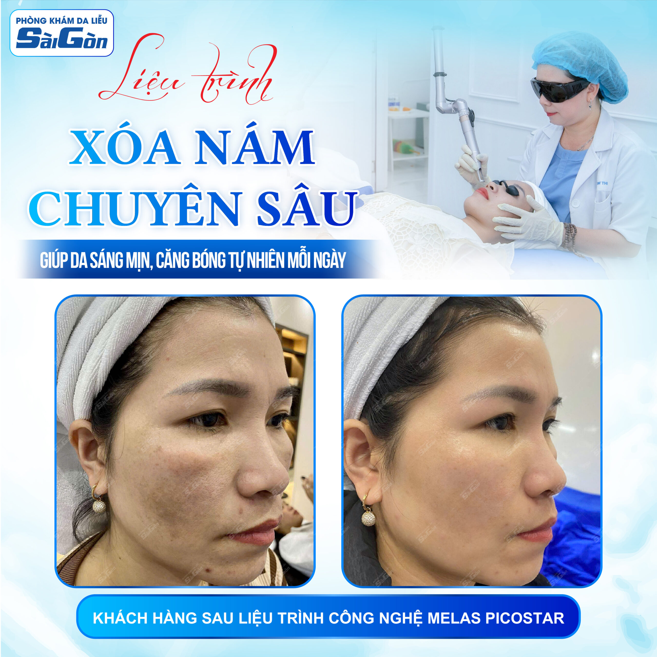 Da liễu khánh hòa